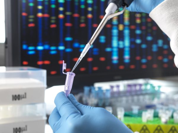 cientistas-criam-teste-genetico-para-identificar-cegueira-em-caes