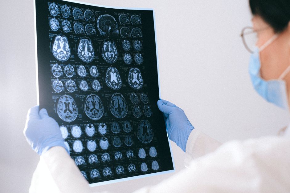 novo-tratamento-se-mostra-promissor-contra-cancer-de-cerebro-agressivo