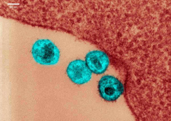 hiv:-nova-variante-esta-circulando-em-tres-estados-do-brasil,-diz-estudo