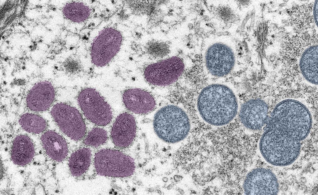 mpox-e-sexualmente-transmissivel?-entenda-relacao-entre-sexo-e-a-doenca