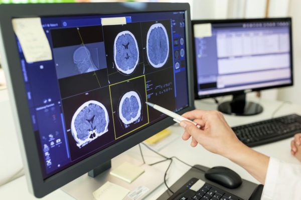 doencas-neurodegenerativas:-o-que-sao,-sinais-de-alerta-e-como-diagnosticar