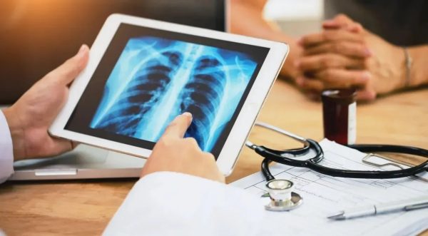 alem-de-fumar:-veja-habitos-que-trazem-risco-de-desenvolver-cancer-de-pulmao