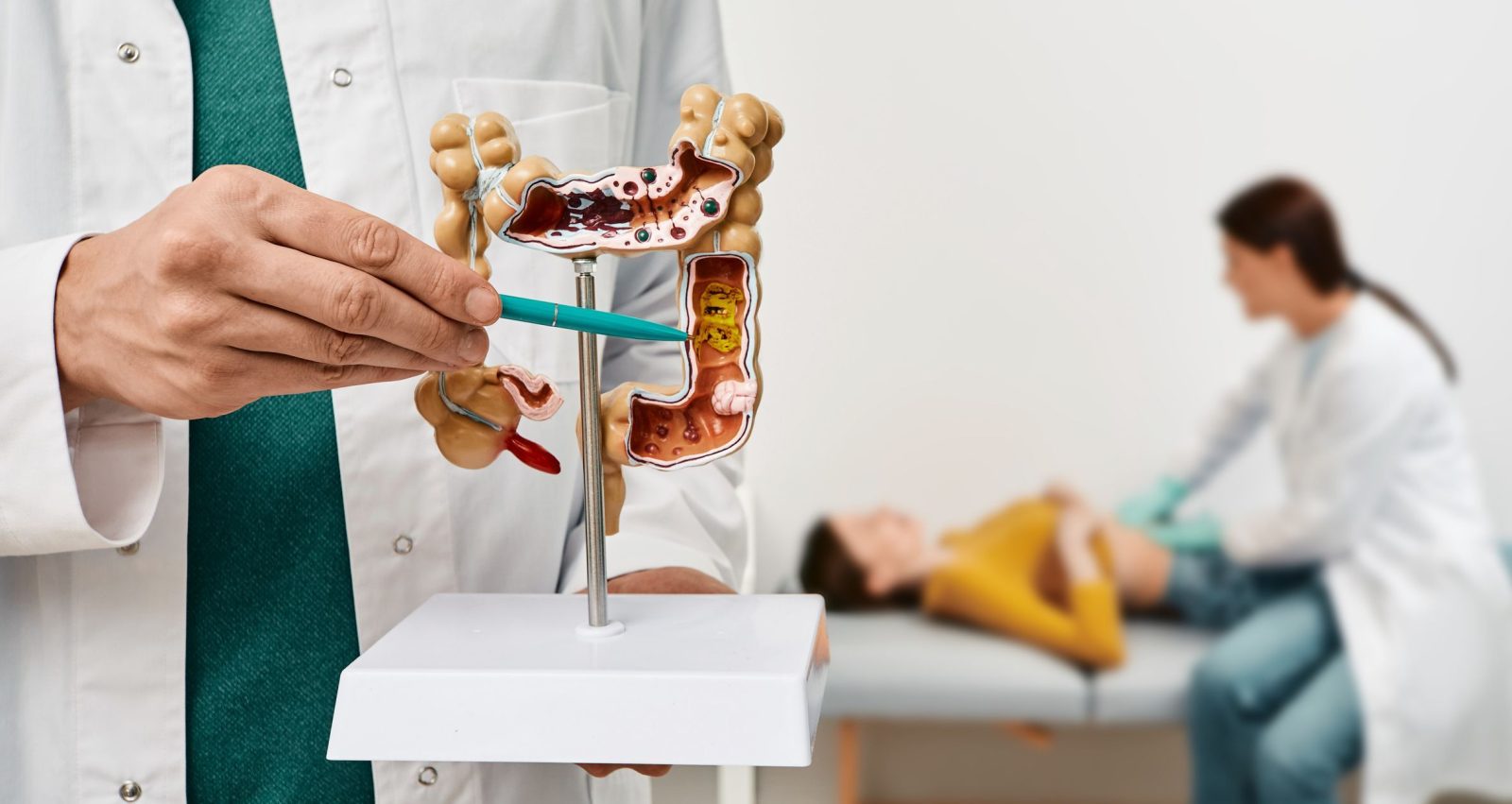 cancer-colorretal:-quando-a-amputacao-do-reto-e-indicada?