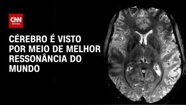 estudo-mostra-como-a-pandemia-pode-ter-afetado-o-cerebro-de-adolescentes