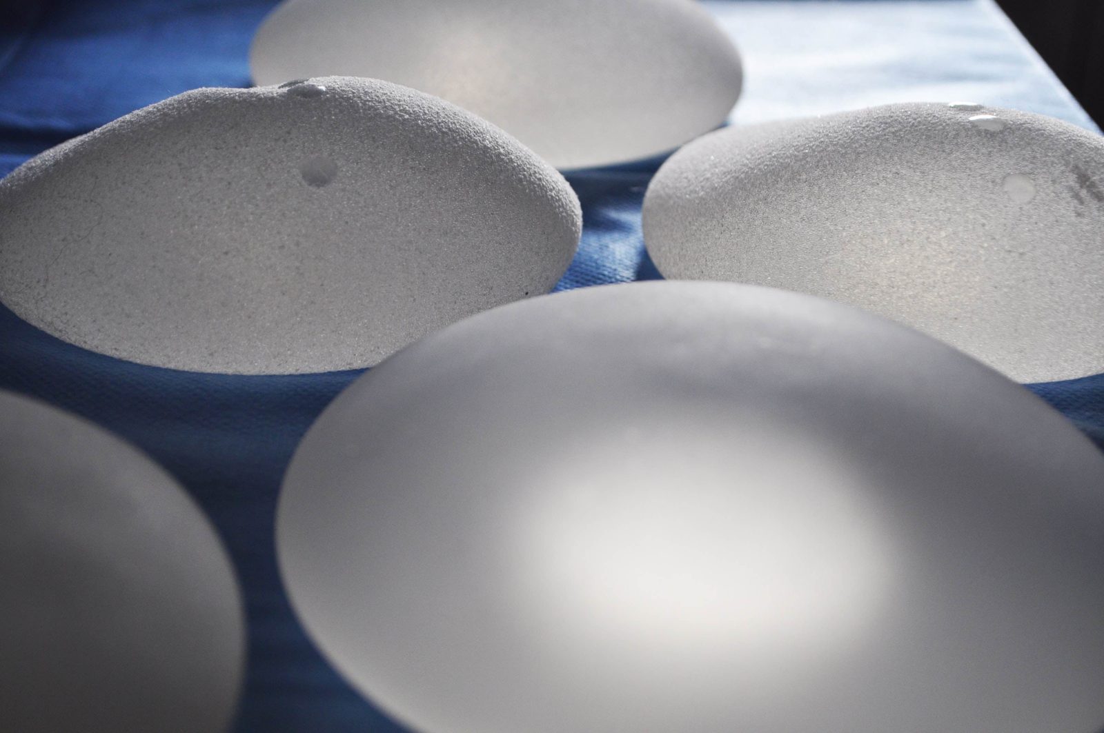 explante-de-silicone:-por-que-mulheres-optam-por-tirar-a-protese?