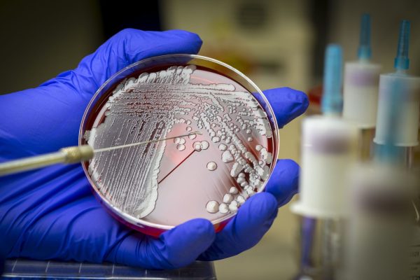resistencia-a-antibioticos-podera-matar-mais-de-39-milhoes-ate-2050,-diz-estudo