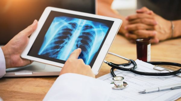 cancer-de-pulmao:-novo-robo-pode-acelerar-em-meses-o-diagnostico