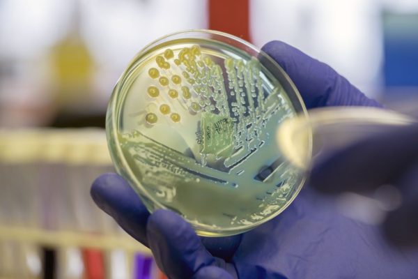 superbacteria-que-representa-risco-de-saude-global-e-detectada-no-nordeste