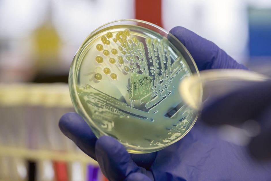 superbacteria-que-representa-risco-de-saude-global-e-detectada-no-nordeste