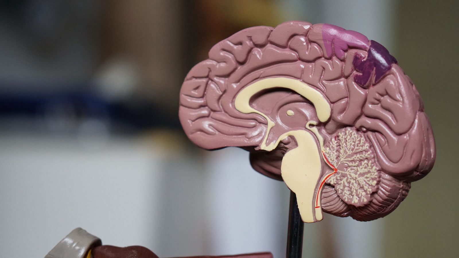 alzheimer-precoce:-veja-sinais-de-alerta-que-podem-surgir-ja-aos-50-anos