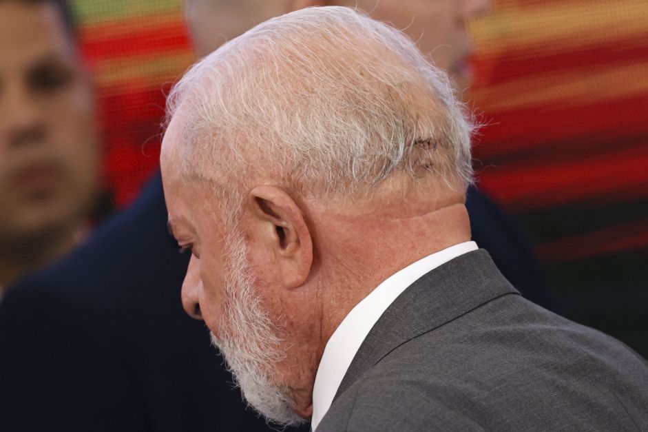lula-faz-novos-exames-de-imagem-apos-quase-duas-semanas-do-acidente-domestico