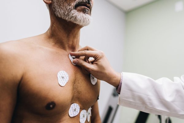 ia-ajuda-a-identificar-precocemente-tipo-comum-de-arritmia-cardiaca
