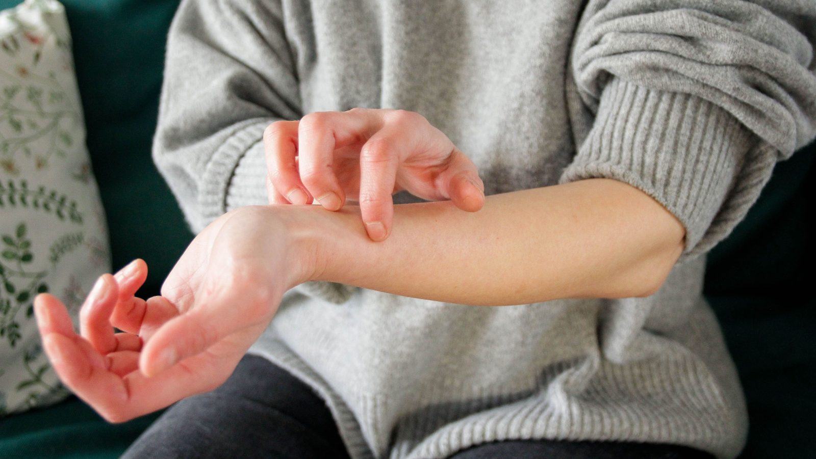 dermatite-atopica:-novo-medicamento-e-opcao-para-casos-moderados-e-graves