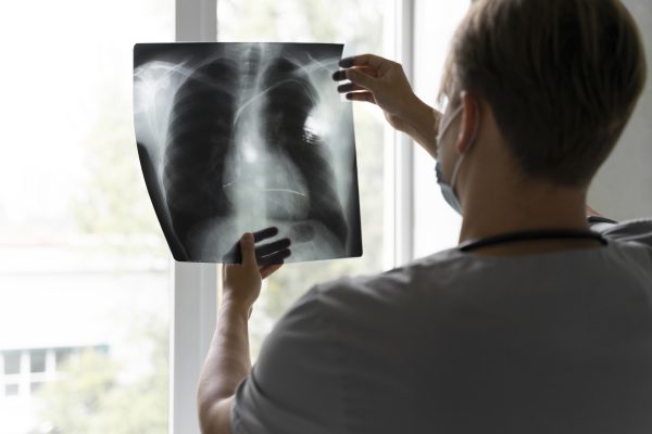 cancer-de-pulmao-pode-ser-detectado-no-ar-expirado,-diz-estudo