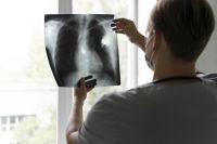 gene-envolvido-no-cancer-de-pulmao-e-descoberto-por-novo-estudo