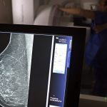 agu-processa-medico-que-apontou-mamografia-como-causadora-de-cancer