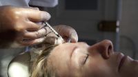 medica-aplica-botox-em-apenas-um-lado-do-rosto-para-mostrar-efeitos;-veja
