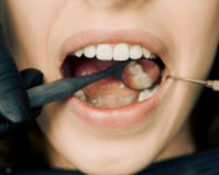 ong-seleciona-jovens-para-tratamento-dental-gratuito-em-148-municipios