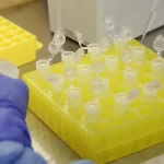 sp-confirma-segundo-caso-importado-de-sarampo