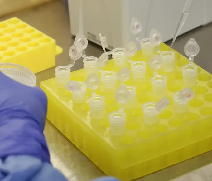 sp-confirma-segundo-caso-importado-de-sarampo